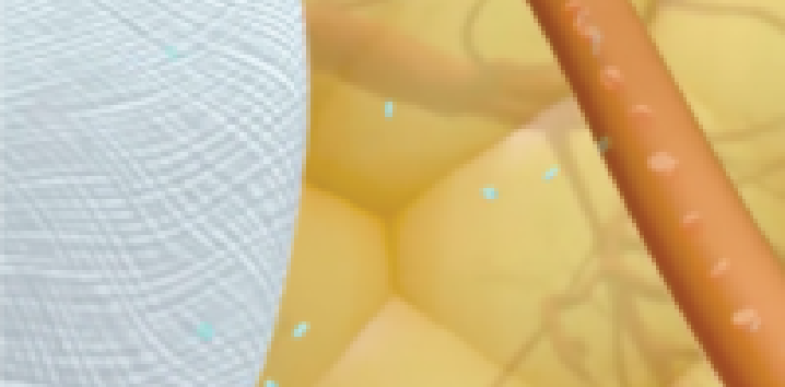 Illustration showing lanreotide being slowly released