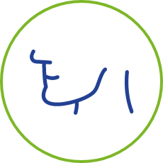 Enlarged hands and/or feet