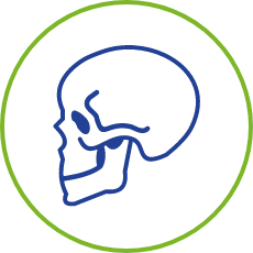 Abnormal bone growth in the face